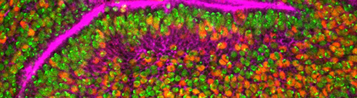 Green and purple and red dots inside a pink circle