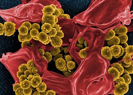 Colorized scanning electron micrograph of MRSA bacteria (gold) interacting with a human neutrophil (red).