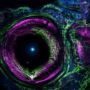 Green branches around a large purple circle: the blood vessels are in purple; the lymph vessels are in green.