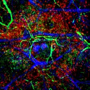 Green and blue webbing over red and and white splotches