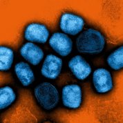 Blue cylindrical mpox virus particles cluster together on an orange background.