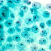 Microscopic human stomach cells stained light blue