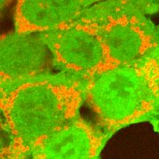 RNAi to find genes that interact with parkin (green), a protein that tags damaged mitochondria