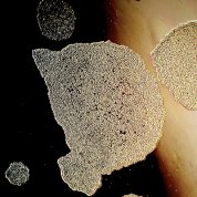 iPSC colonies captured using phase contrast microscopy